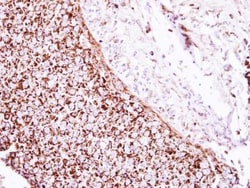 Glutamate Dehydrogenase Antibody, Novus Biologicals 0.1mL; Unlabeled:Antibodies,