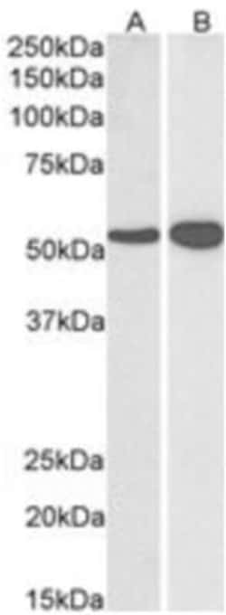 Glutamate Dehydrogenase Antibody, Novus Biologicals 0.1mg; Unlabeled:Antibodies,