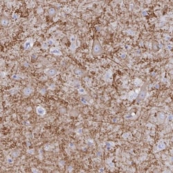 GluR1 Antibody, Novus Biologicals 25 &mu;L, Unlabeled:Anticuerpos