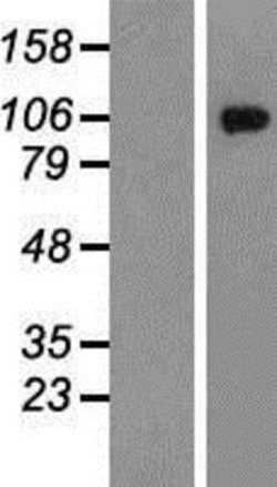 Novus Biologicals&trade;&nbsp;Glutamate Receptor 6 Overexpression Lysate