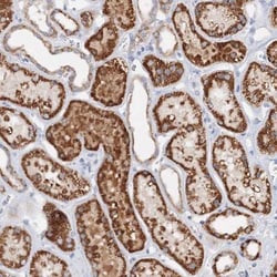 Glutaminase Antibody, Novus Biologicals 0.1mL; Unlabeled:Antibodies, Polyclonal