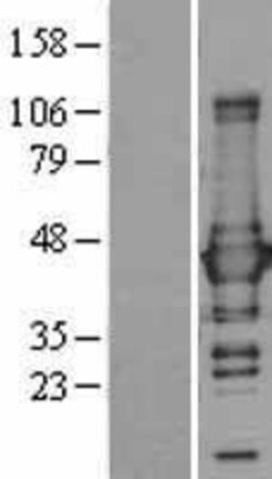 Novus Biologicals&trade;&nbsp;Glutamine Synthetase Overexpression Lysate