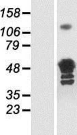 Novus Biologicals&trade;&nbsp;Glutamine Synthetase Overexpression Lysate