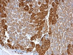 Glutamine Synthetase Antibody (1055), Novus Biologicals 0.1mL; Unlabeled:Antibodies,