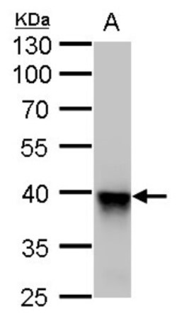 Glutamine Synthetase Antibody (1055), Novus Biologicals 0.1mL; Unlabeled:Antibodies,