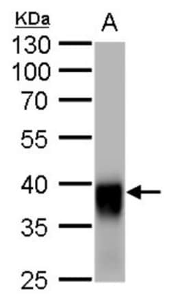 Glutamine Synthetase Antibody (1055), Novus Biologicals 0.1mL; Unlabeled:Antibodies,