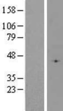 Novus Biologicals™ Glutathione Peroxidase 4/GPX4 Overexpression Lysate