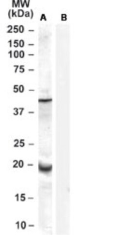 Glutathione Peroxidase 7 Antibody, Novus Biologicals 0.1mg; Unlabeled:Antibodies,