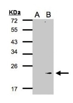 Glutathione Peroxidase 7 Antibody, Novus Biologicals 0.1mL; Unlabeled:Antibodies,