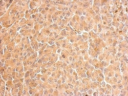 Glutathione Reductase Antibody, Novus Biologicals 0.1mL; Unlabeled:Antibodies,