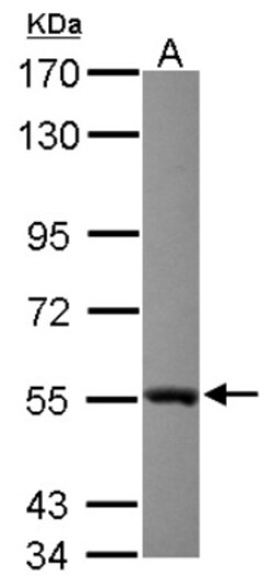 Glutathione Reductase Antibody, Novus Biologicals 0.1mL; Unlabeled:Antibodies,