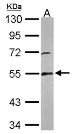 Glutathione Reductase Antibody, Novus Biologicals 0.1mL; Unlabeled:Antibodies,