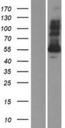 Novus Biologicals&trade;&nbsp;Glutathione Reductase Overexpression Lysate