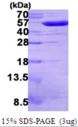 Novus Biologicals&trade;&nbsp;Recombinant E. coli Glutathione Reductase His Protein