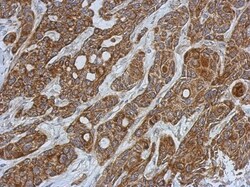 Glutathione S Transferase kappa 1 Antibody, Novus Biologicals 0.1mL; Unlabeled:Antibodies,