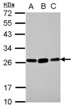 Glutathione S Transferase kappa 1 Antibody, Novus Biologicals 0.1mL; Unlabeled:Antibodies,