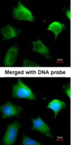 Glutathione S-transferase Mu 5 Antibody, Novus Biologicals 0.1mg; Unlabeled:Antibodies,