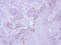 Glutathione S-transferase Mu 5 Antibody, Novus Biologicals 0.1mg; Unlabeled:Antibodies,