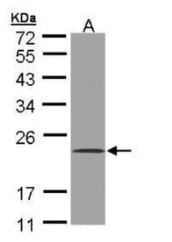 Glutathione S-transferase Mu 5 Antibody, Novus Biologicals 0.1mg; Unlabeled:Antibodies,