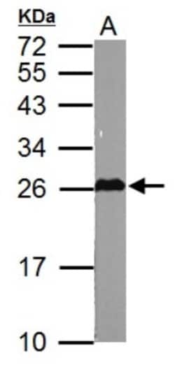 Glutathione S-transferase Mu 5 Antibody, Novus Biologicals 0.1mg; Unlabeled:Antibodies,