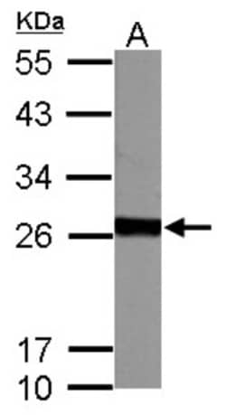 Glutathione S-transferase Mu 5 Antibody, Novus Biologicals 0.1mg; Unlabeled:Antibodies,