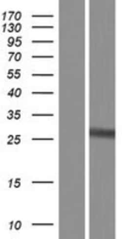 Novus Biologicals&trade;&nbsp;Glutathione S-transferase Mu 5 Overexpression Lysate
