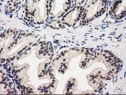 Glutathione Synthetase Antibody (OTI1B8), Novus Biologicals 0.1mL; Unlabeled:Antibodies,