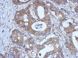 Glutathione Peroxidase 2/GPX2 Antibody, Novus Biologicals 0.1mg; Unlabeled:Antibodies,