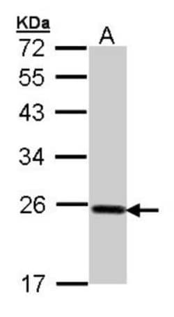 Glutathione Peroxidase 2/GPX2 Antibody, Novus Biologicals 0.1mg; Unlabeled:Antibodies,