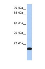 Glutathione Peroxidase 4/GPX4 Antibody, Novus Biologicals 100 μL | Buy  Online | Novus Biologicals