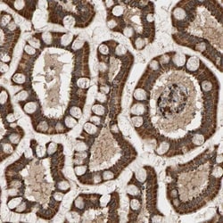 Glutathione S Transferase kappa 1 Antibody, Novus Biologicals:Antibodies:Primary