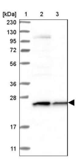 Glutathione S Transferase kappa 1 Antibody, Novus Biologicals:Antibodies:Primary