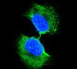 Glutathione S-Transferase pi 1/GSTP1 Antibody (3F2C2), Novus Biologicals