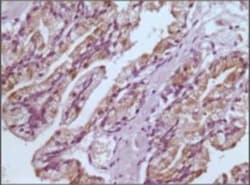 Glutathione S-Transferase pi 1/GSTP1 Antibody (3F2C2), Novus Biologicals