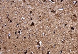 Glutathione S-Transferase pi 1/GSTP1 Antibody, Novus Biologicals 0.1mL;