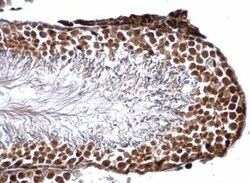 Glutathione S-Transferase pi 1/GSTP1 Antibody, Novus Biologicals 0.1mL;
