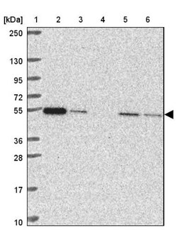 Glutathione Synthetase Antibody, Novus Biologicals 0.1mL; Unlabeled:Antibodies,