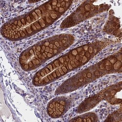 GLXR5 Antibody, Novus Biologicals:Antibodies:Primary Antibodies