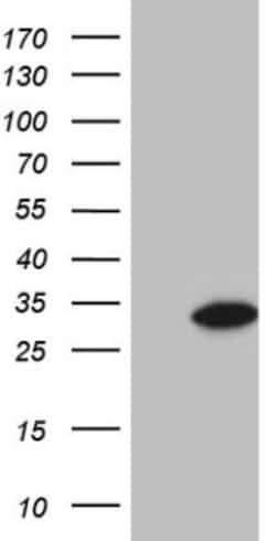 GLYAT Antibody (OTI4D1), Novus Biologicals 0.1mL; Unlabeled:Antibodies,