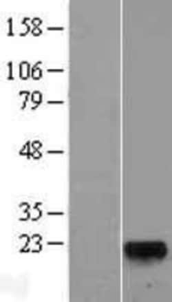 Novus Biologicals&trade;&nbsp;GLYAT Overexpression Lysate