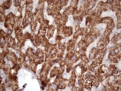 GLYAT Antibody (OTI4D1), Novus Biologicals 0.1mL; Unlabeled:Antibodies,