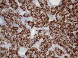 GLYAT Antibody (OTI4D1), Novus Biologicals 0.1mL; Unlabeled:Antibodies,