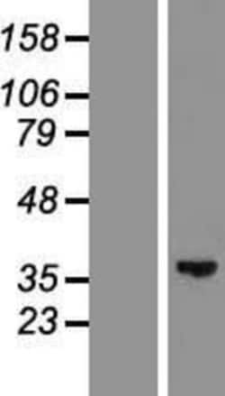 Novus Biologicals&trade;&nbsp;GLYATL2 Overexpression Lysate