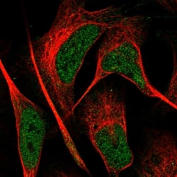 GLYATL3 Antibody, Novus Biologicals 25 &mu;L | Buy Online | Novus Biologicals | Fisher Scientific