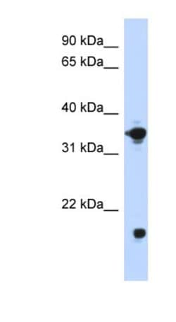 Glycerol 3 Phosphate Dehydrogenase Antibody, Novus Biologicals 20&mu;L;
