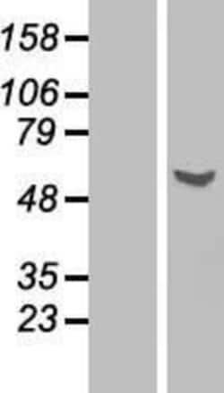 Novus Biologicals&trade;&nbsp;Glycerol Kinase Overexpression Lysate