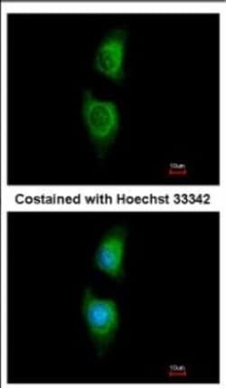 Glycerol 3 Phosphate Dehydrogenase Antibody, Novus Biologicals 0.1mL; Unlabeled:Antibodies,