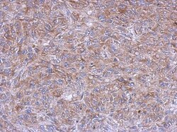 Glycerol 3 Phosphate Dehydrogenase Antibody, Novus Biologicals 0.1mL; Unlabeled:Antibodies,