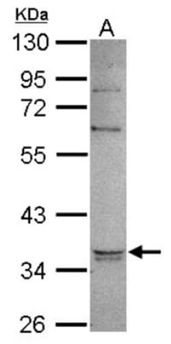 Glycerol 3 Phosphate Dehydrogenase Antibody, Novus Biologicals 0.1mL; Unlabeled:Antibodies,