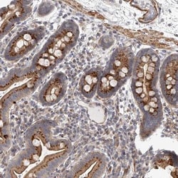 glycerol-3-phosphate permease Antibody, Novus Biologicals 0.1mL; Unlabeled:Antibodies,